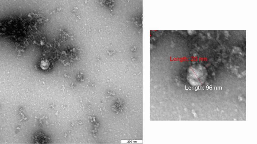 Российские ученые первые в мире сфотографировали 'британский' штамм COVID-19